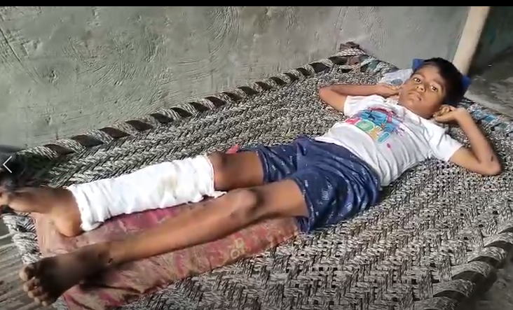 मुज़फ्फरनगर में पिटबुल डॉग ने 6 साल के मासूम पर किया हमला, घायल, एक गिरफ्तार