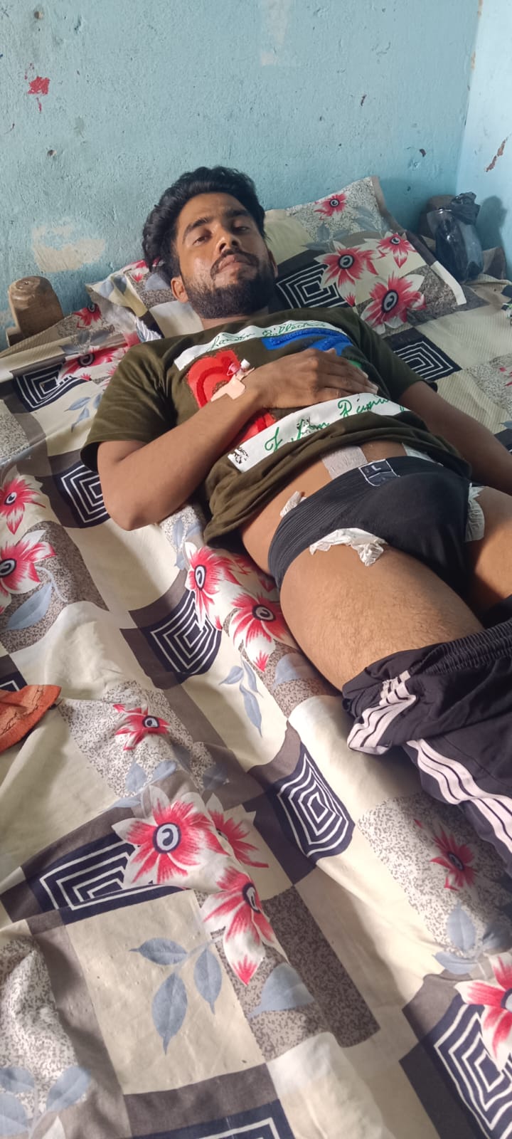 मुज़फ्फरनगर में 'अपना हॉस्पिटल' बना लापरवाही का अड्डा,ऑपरेशन में काट दी नस, पीड़ित ने SSP-CMO से की इंसाफ की मांग