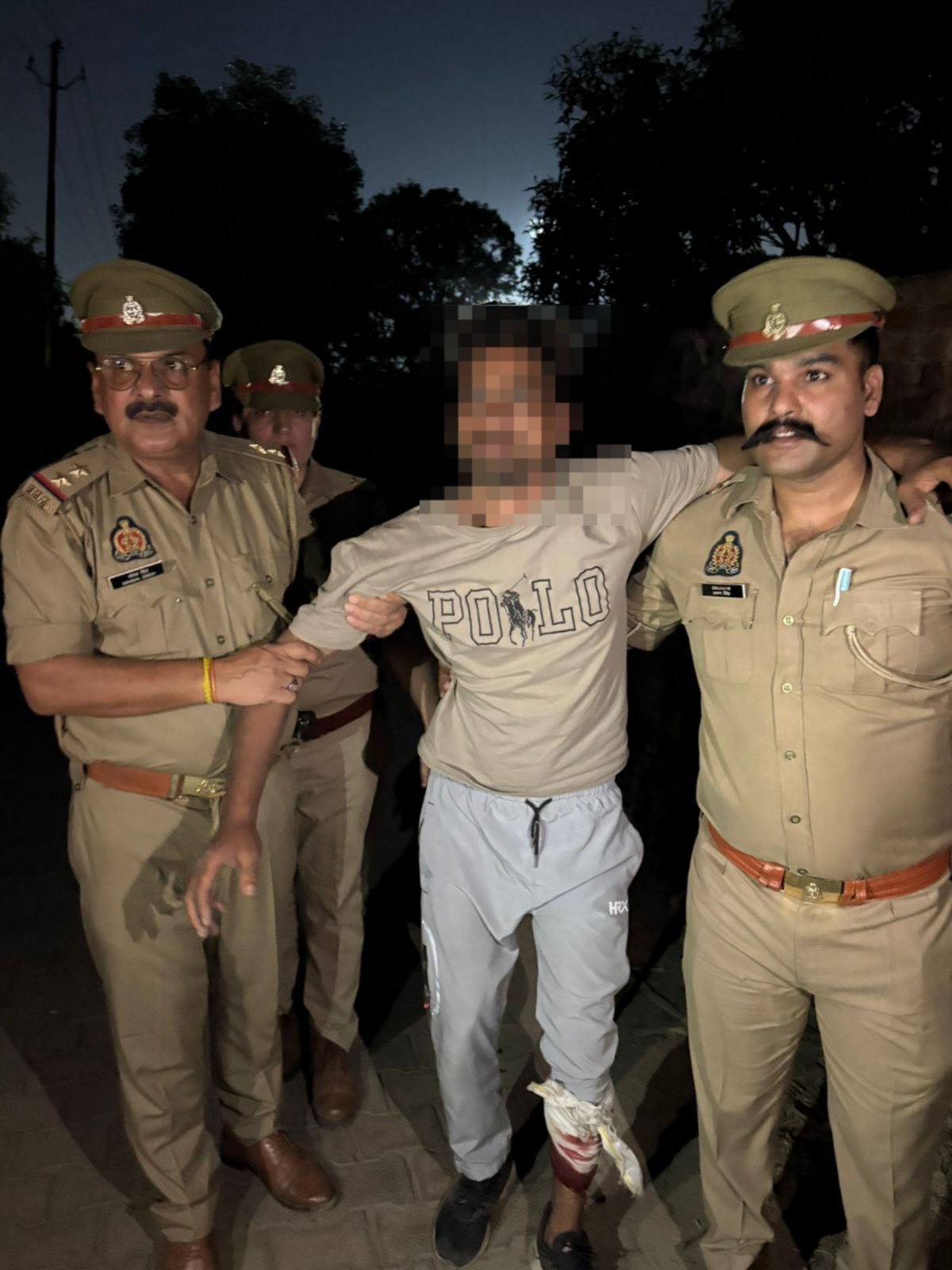 गाजियाबाद में महिला मिशन शक्ति के तहत स्नैचिंग रोकने पर पुलिस मुठभेड़, घायल बदमाश ने गिड़गिड़ाया- 