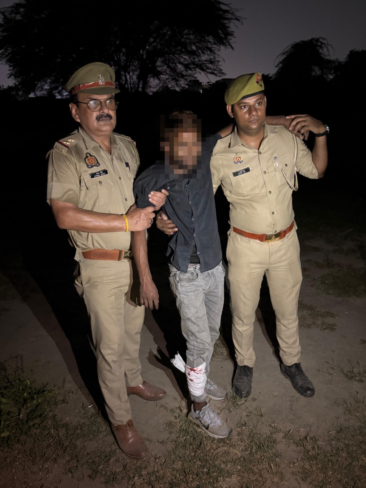 गाजियाबाद में मुठभेड़: वांछित चेन स्नैचर यामीन गिरफ्तार, पैर में गोली लगने से घायल