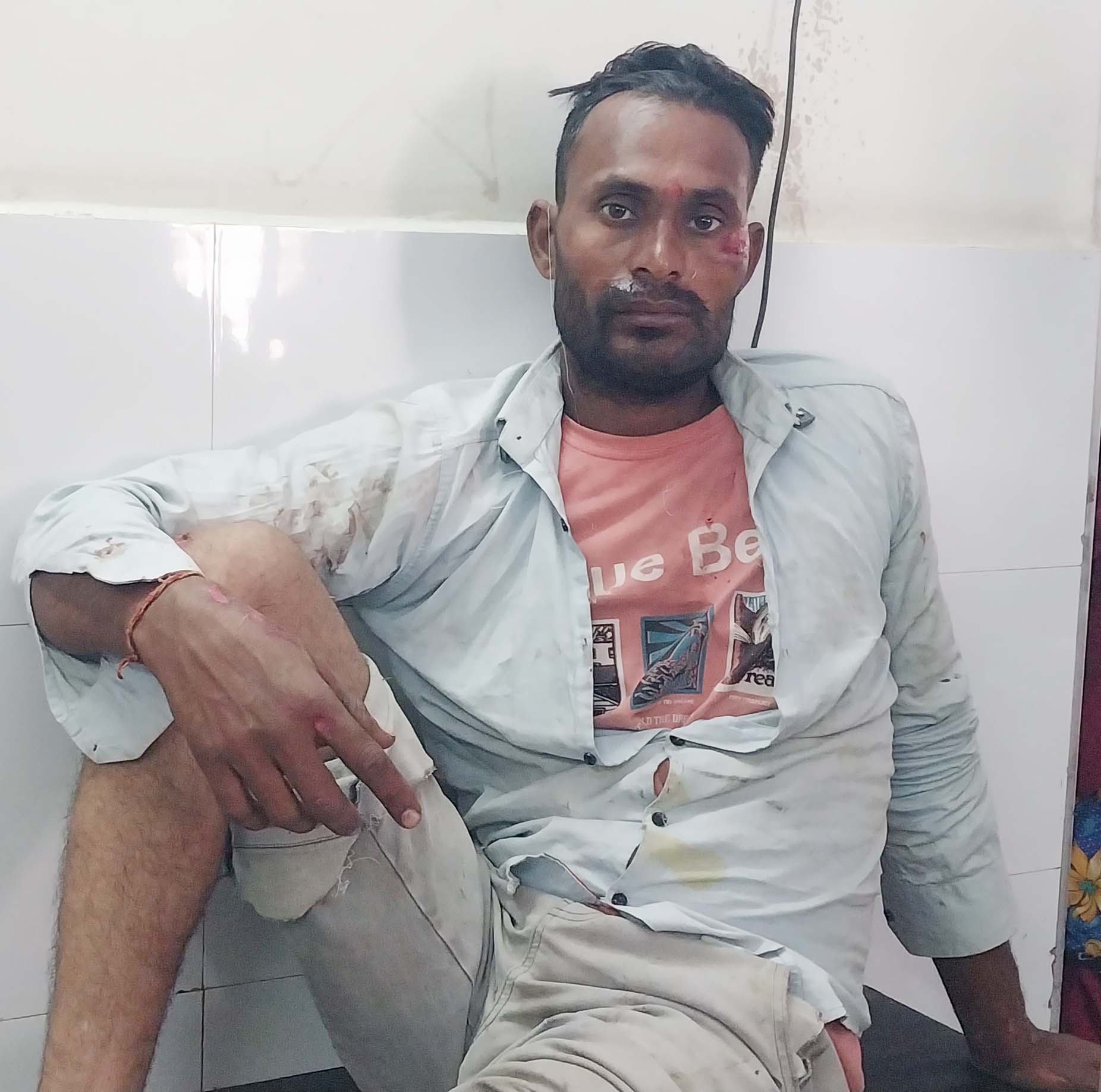 शामली के कैराना बाईपास पर बाइक गिरने से युवक गंभीर रूप से घायल