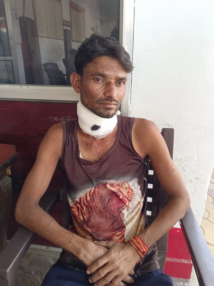मुजफ्फरनगर में पति-पत्नी का हाई-वोल्टेज ड्रामा, एक-दूसरे पर धारदार हथियार से हमले और मारपीट का आरोप