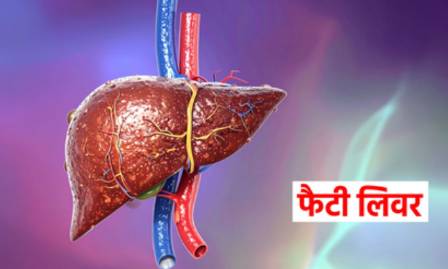 फैटी लिवर: बिना लक्षण के बढ़ती गंभीर बीमारी, आयुर्वेदिक उपायों से करें नियंत्रण