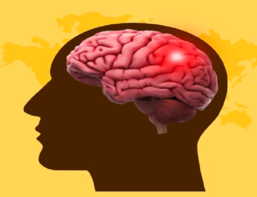 विश्व स्ट्रोक दिवस पर जानिए—योग और सही जीवनशैली से कैसे करें ब्रेन स्ट्रोक से बचाव