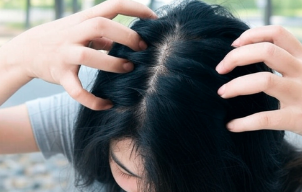 सर्दियों में सिर की खुजली से राहत के लिए अपनाएं ये घरेलू और आयुर्वेदिक उपाय