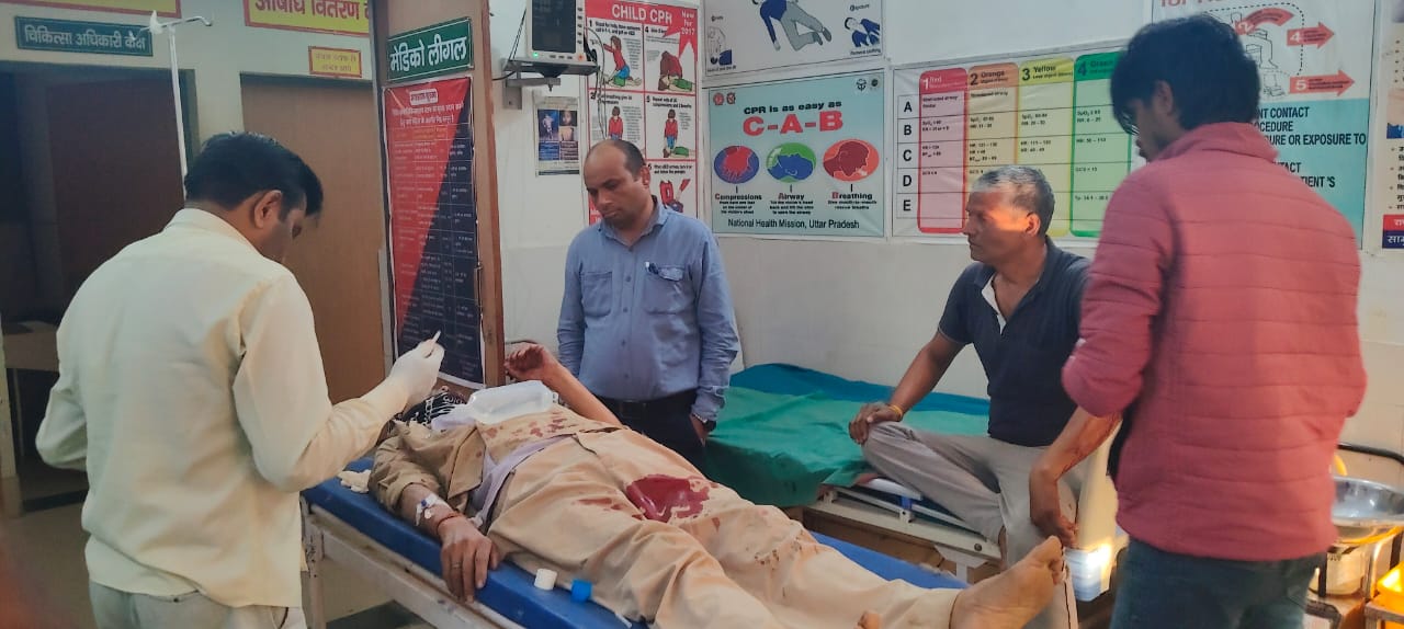 मुज़फ्फरनगर में दीपावली की कहासुनी ने लिया हिंसक रूप, दो पक्षों में खूनी संघर्ष, पांच घायल, एक गिरफ्तार