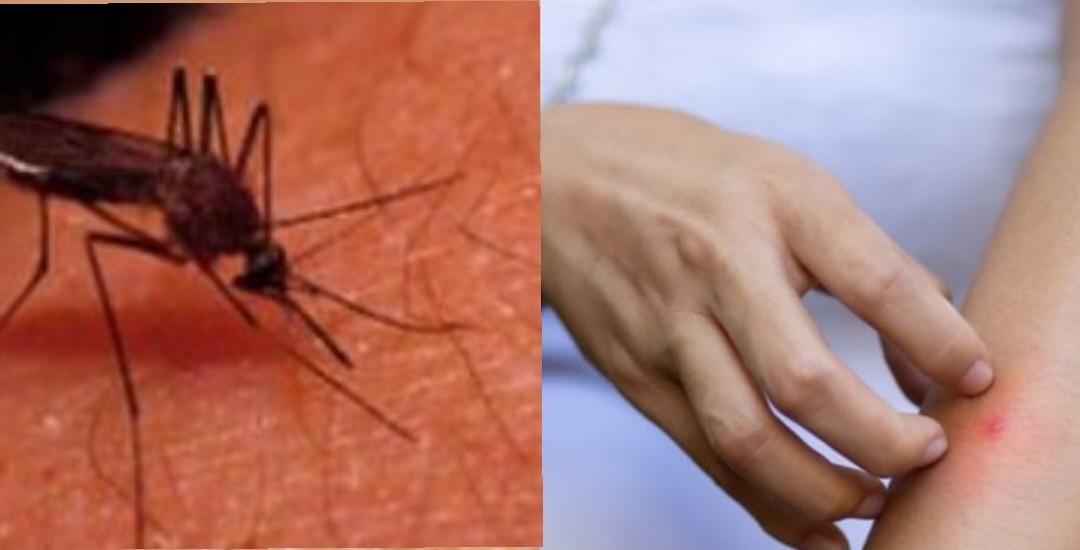 देवबंद में मच्छरों का प्रकोप बढ़ा, वायरल बुखार और मलेरिया का खतरा