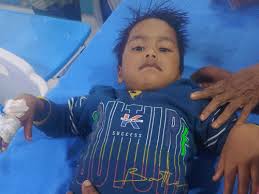 लखनऊ: नगर निगम की गाड़ी ने मासूम बच्चे को कुचला, सड़क पर बिखरे मांस के टुकड़े; डॉक्टर बोले- पैर काटना पड़ेगा