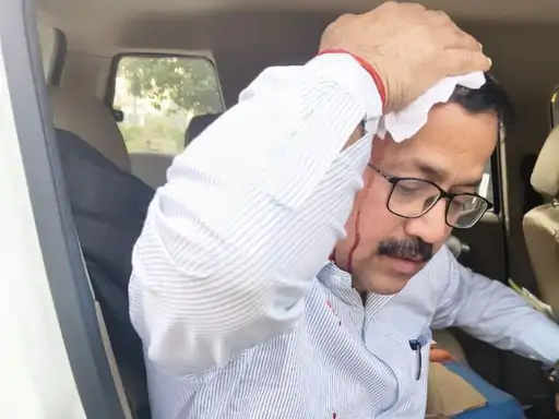 बुलडोजर लेकर पहुंचे नायब तहसीलदार पर हमला, सिर फटा; भीड़ ने तीन झोपड़ियों में आग लगाई