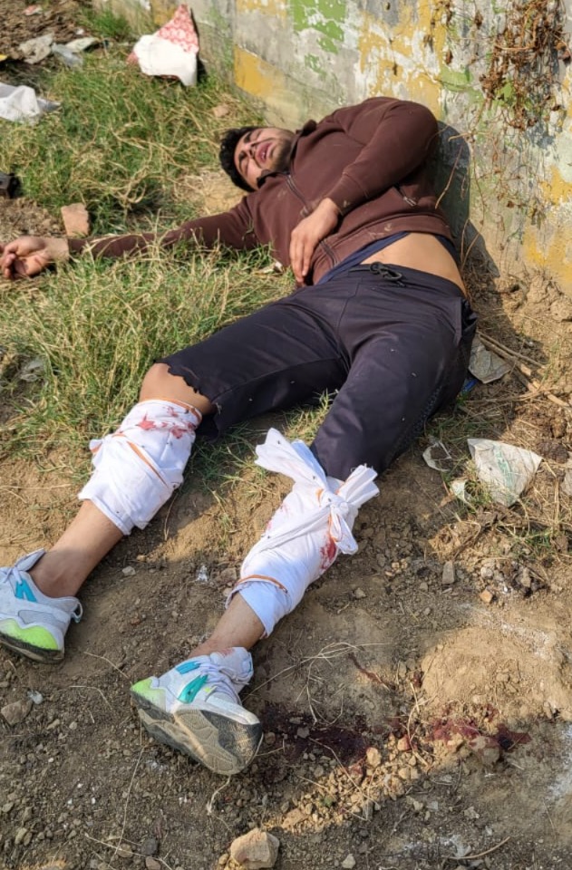 गाजियाबाद: लूट और स्नैचिंग के दो शातिर बदमाश मुठभेड़ में दबोचे, तमंचे और मोटरसाइकिल बरामद