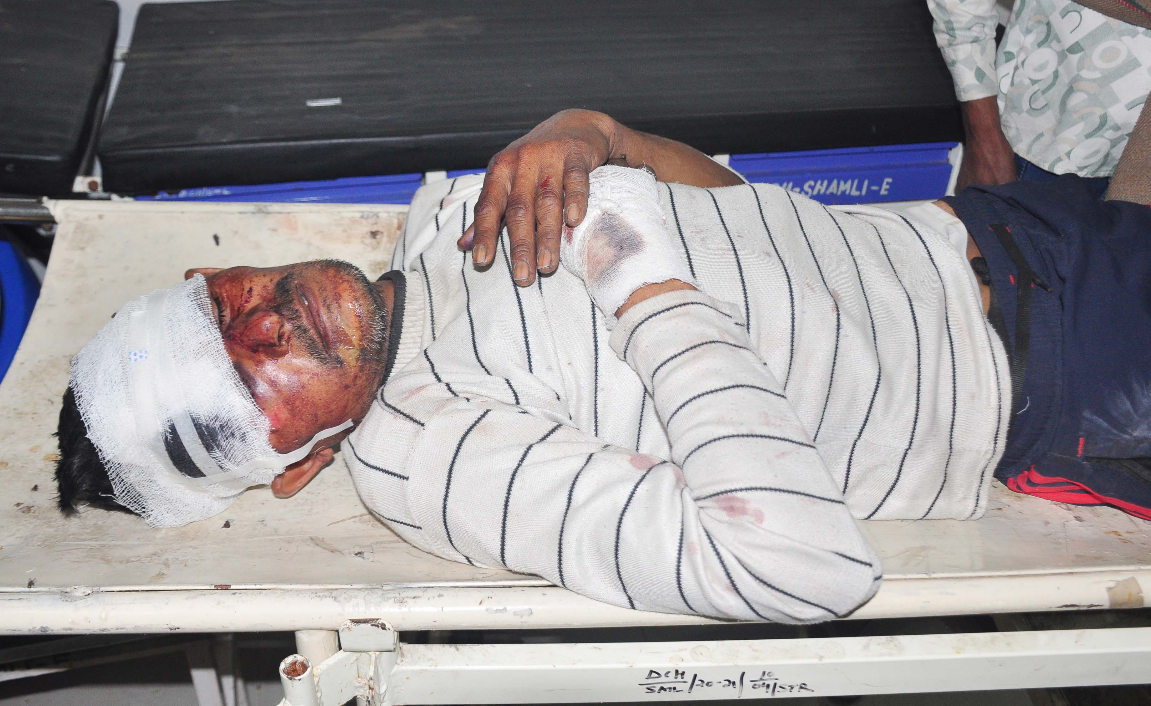 शामली: बाइक और कार की टक्कर में दो युवक गंभीर रूप से घायल