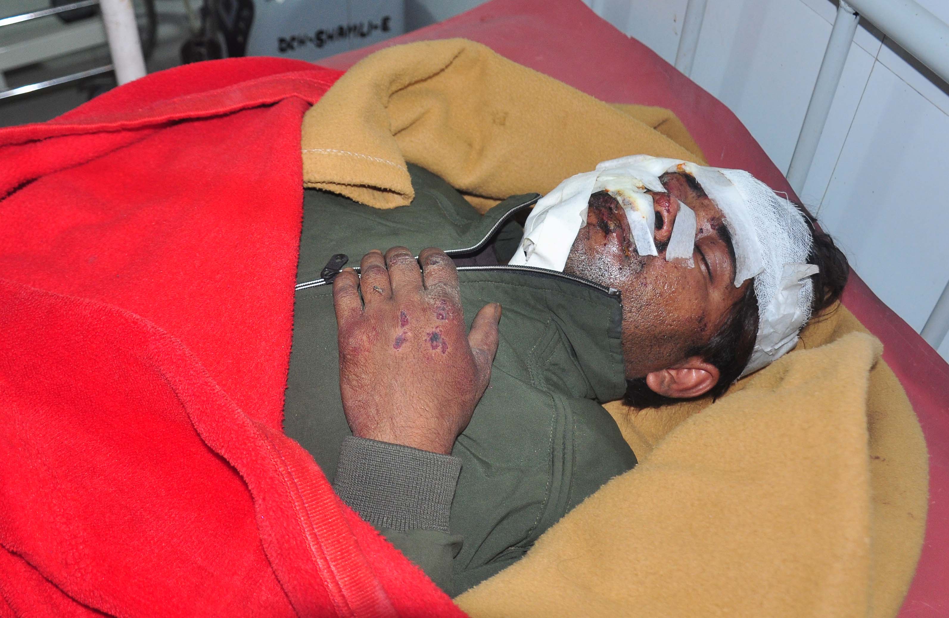 शामली में मेरठ-करनाल हाईवे पर अज्ञात वाहन की टक्कर से युवक घायल, जिला अस्पताल में भर्ती