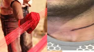 जौनपुर में  प्रतिबंधित चाइनीज़ मांझा का कहर जारी, फिर कटी एक युवक की गर्दन