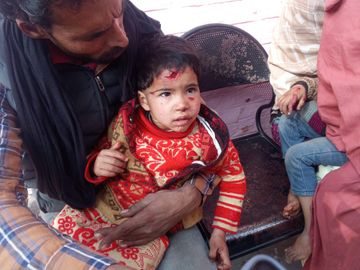 सहारनपुर के रामपुर मनिहारान गांव नाई नगली में कुत्तों के हमले में दो बच्चे गंभीर रूप से घायल