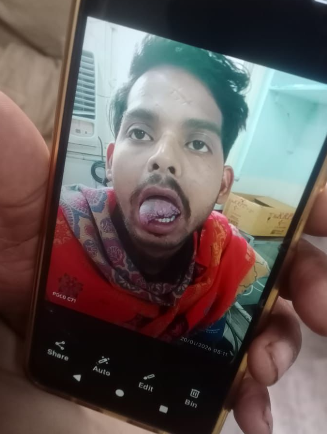 गाजियाबादः मोदीनगर में खाना बनाने के विवाद में पत्नी ने चाकू से काटी पति की जीभ, बोलने की शक्ति खो सकता है युवक