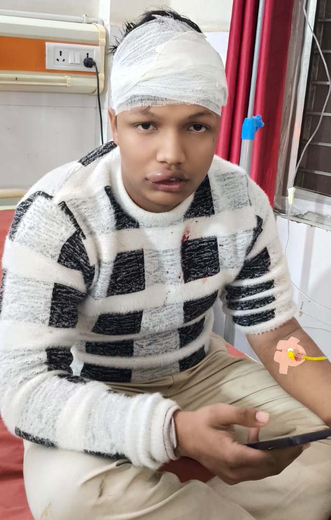 शामली: माजरा रोड पर हथियारबंद युवकों ने मोबाइल व्यापारी से लूट की