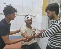 हाथरस के सलेमपुर गांव में आतिशबाजी को लेकर दो पक्षों में विवाद, दो युवक घायल