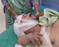 DM की स्कॉर्ट गाड़ी ने दिव्यांग को कुचला, तीन बाइकों को टक्कर मारी; भीड़ ने ड्राइवर-होमगार्ड को पीटा