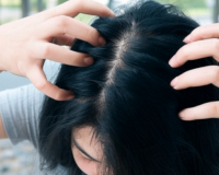 सर्दियों में सिर की खुजली से राहत के लिए अपनाएं ये घरेलू और आयुर्वेदिक उपाय