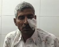 बागपत में तीन युवकों ने छात्रा के साथ की छेड़छाड़, पिता को चाकू मारकर किया घायल,आरोपी फरार 