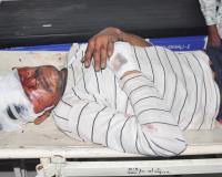 शामली: बाइक और कार की टक्कर में दो युवक गंभीर रूप से घायल