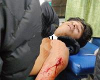 मुज़फ़्फ़रनगर में पुलिस चौकी से चंद कदम दूर दो गुटों में खूनी संघर्ष, एसडी मार्केट में युवक को चाकू घोंपा; मेरठ रेफर