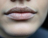 मुंह सूखना सिर्फ डिहाइड्रेशन नहीं, गंभीर रोगों का संकेत भी, आयुर्वेद से जानें समाधान