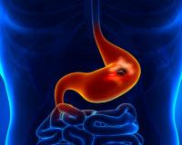 चुपचाप पैर पसारती है ये आंत से जुड़ी बीमारी, लक्षणों को न करें अनदेखा 