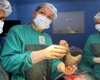 बिहार : ऑपरेशन के दौरान महिला के पेट से निकला डेढ किलो बालों का गुच्छा