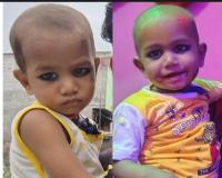 औरैया: कफ सीरप पीने के बाद दो भाइयों की बिगड़ी तबियत, बड़े भाई रोहन की मौत, छोटा सैफई रेफर