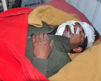 शामली में मेरठ-करनाल हाईवे पर अज्ञात वाहन की टक्कर से युवक घायल, जिला अस्पताल में भर्ती