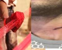 जौनपुर में  प्रतिबंधित चाइनीज़ मांझा का कहर जारी, फिर कटी एक युवक की गर्दन