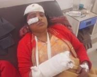 शामली में राम भरोसे चल रही सदर कोतवाली: हमले के बाद अगले दिन तक पीड़ितों के पास नही पहुुंची पुलिस