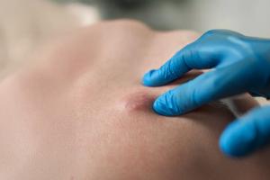 क्या शरीर में बनने वाली हर गांठ खतरनाक होती है? आयुर्वेद से जानें अर्बुद और ग्रन्थि में फर्क