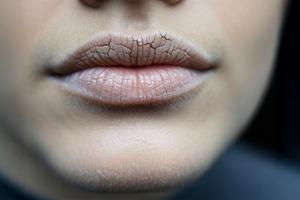 मुंह सूखना सिर्फ डिहाइड्रेशन नहीं, गंभीर रोगों का संकेत भी, आयुर्वेद से जानें समाधान