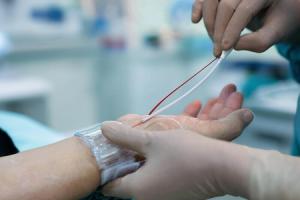 दिल की सेहत के लिए जरूरी है एंजियोग्राफी, जानिए क्या है यह टेस्ट और इसकी सावधानियां 